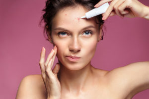 maedchengesicht mit akne - kosmetik-studio - stuttgart - carola kiesel - beauty-balance