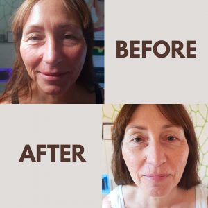 Kundin Vorher.Nachher-Vergleich jetcare med