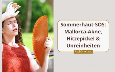 Sommerhaut-SOS: Mallorca-Akne und Hitzepickel
